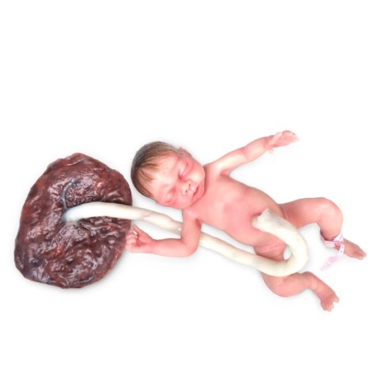 Baby preemie22